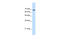 Transglutaminase 2 antibody, 30-288, ProSci, Enzyme Linked Immunosorbent Assay image 