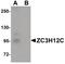 Zinc Finger CCCH-Type Containing 12C antibody, PA5-20928, Invitrogen Antibodies, Western Blot image 
