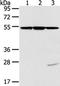 Tubulin Alpha 1c antibody, TA350552, Origene, Western Blot image 