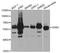 Asparagine Synthetase (Glutamine-Hydrolyzing) antibody, A5558, ABclonal Technology, Western Blot image 