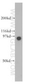 N-acetylglucosamine-6-sulfatase antibody, 13044-1-AP, Proteintech Group, Western Blot image 