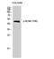 BLNK antibody, STJ90847, St John