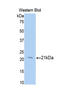 Beta-N-Acetylglucosaminidase antibody, LS-C304731, Lifespan Biosciences, Western Blot image 