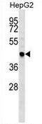 TNF Receptor Associated Factor 4 antibody, AP54351PU-N, Origene, Western Blot image 