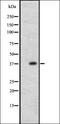 MAGE Family Member A9B antibody, orb337596, Biorbyt, Western Blot image 