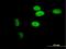 Tim1 antibody, H00008914-B01P, Novus Biologicals, Immunocytochemistry image 