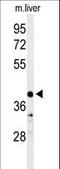 Carbonic Anhydrase 5B antibody, LS-C168243, Lifespan Biosciences, Western Blot image 