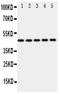 Interferon Regulatory Factor 3 antibody, PA1819, Boster Biological Technology, Western Blot image 