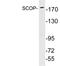 PH Domain And Leucine Rich Repeat Protein Phosphatase 1 antibody, A02430, Boster Biological Technology, Western Blot image 