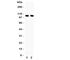 Nuclear Factor Kappa B Subunit 1 antibody, R31224, NSJ Bioreagents, Western Blot image 