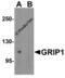 Glutamate Receptor Interacting Protein 1 antibody, 7229, ProSci Inc, Western Blot image 