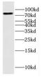 ERCC Excision Repair 2, TFIIH Core Complex Helicase Subunit antibody, FNab02833, FineTest, Western Blot image 