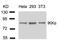 Component Of Inhibitor Of Nuclear Factor Kappa B Kinase Complex antibody, GTX50469, GeneTex, Western Blot image 