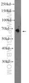 Otopetrin 1 antibody, 24456-1-AP, Proteintech Group, Western Blot image 