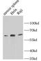 Transcription Factor EB antibody, FNab08627, FineTest, Western Blot image 