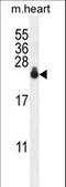 Adaptor Related Protein Complex 1 Subunit Sigma 3 antibody, LS-C156384, Lifespan Biosciences, Western Blot image 