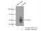 BMP And Activin Membrane Bound Inhibitor antibody, 16100-1-AP, Proteintech Group, Immunoprecipitation image 