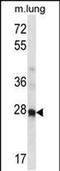 Homeobox A4 antibody, PA5-48714, Invitrogen Antibodies, Western Blot image 