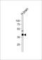 Phosphatidylinositol-4-Phosphate 5-Kinase Type 1 Gamma antibody, MBS9204711, MyBioSource, Western Blot image 