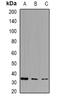 Pyrophosphatase (Inorganic) 1 antibody, abx141668, Abbexa, Western Blot image 