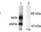 Calcium/Calmodulin Dependent Protein Kinase II Beta antibody, ab32678, Abcam, Western Blot image 