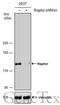 Regulatory-associated protein of mTOR antibody, GTX131508, GeneTex, Western Blot image 