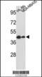 Gasdermin B antibody, 63-516, ProSci, Western Blot image 