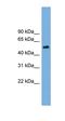 Tubulin Beta 4A Class IVa antibody, orb325721, Biorbyt, Western Blot image 