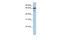 Selenoprotein N antibody, PA5-43082, Invitrogen Antibodies, Western Blot image 