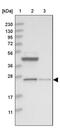 Suppressor Of IKBKE 1 antibody, PA5-55247, Invitrogen Antibodies, Western Blot image 