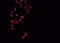 Dynamin 1 Like antibody, GTX01567, GeneTex, Immunocytochemistry image 