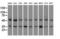 Protein Kinase CAMP-Dependent Type II Regulatory Subunit Alpha antibody, M03911-3, Boster Biological Technology, Western Blot image 