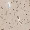 Zinc Finger MYM-Type Containing 6 antibody, NBP1-88520, Novus Biologicals, Immunohistochemistry paraffin image 