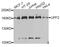 hUpf2 antibody, A03627, Boster Biological Technology, Western Blot image 