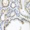 Protein SSX2 antibody, orb247726, Biorbyt, Immunohistochemistry paraffin image 