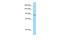 Neuroblastoma breakpoint family member 1 antibody, A15139, Boster Biological Technology, Western Blot image 