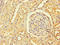 RNA Binding Motif Protein 12 antibody, LS-C397337, Lifespan Biosciences, Immunohistochemistry paraffin image 