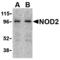 Nucleotide Binding Oligomerization Domain Containing 2 antibody, MBS150770, MyBioSource, Western Blot image 