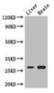 Tetraspanin 8 antibody, A63724-100, Epigentek, Western Blot image 