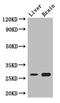 Tetraspanin-8 antibody, A63724-100, Epigentek, Western Blot image 