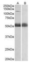 Coatomer Protein Complex Subunit Alpha antibody, orb12264, Biorbyt, Western Blot image 