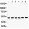 Inhibitor Of Nuclear Factor Kappa B Kinase Regulatory Subunit Gamma antibody, PA1551-1, Boster Biological Technology, Western Blot image 