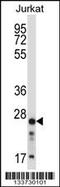 D4 antibody, 57-239, ProSci, Western Blot image 