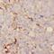 Dihydrouridine Synthase 3 Like antibody, FNab02560, FineTest, Immunohistochemistry paraffin image 