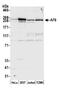 Afadin, Adherens Junction Formation Factor antibody, NBP1-22996, Novus Biologicals, Western Blot image 