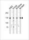 Receptor Tyrosine Kinase Like Orphan Receptor 1 antibody, 63-129, ProSci, Western Blot image 