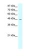 High Mobility Group 20A antibody, orb329688, Biorbyt, Western Blot image 