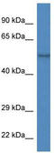 Zinc Finger And BTB Domain Containing 14 antibody, TA334079, Origene, Western Blot image 