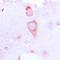 Guanylate Cyclase 1 Soluble Subunit Beta 1 antibody, orb214027, Biorbyt, Immunohistochemistry paraffin image 