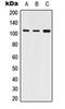ATPase Sarcoplasmic/Endoplasmic Reticulum Ca2+ Transporting 2 antibody, orb215439, Biorbyt, Western Blot image 